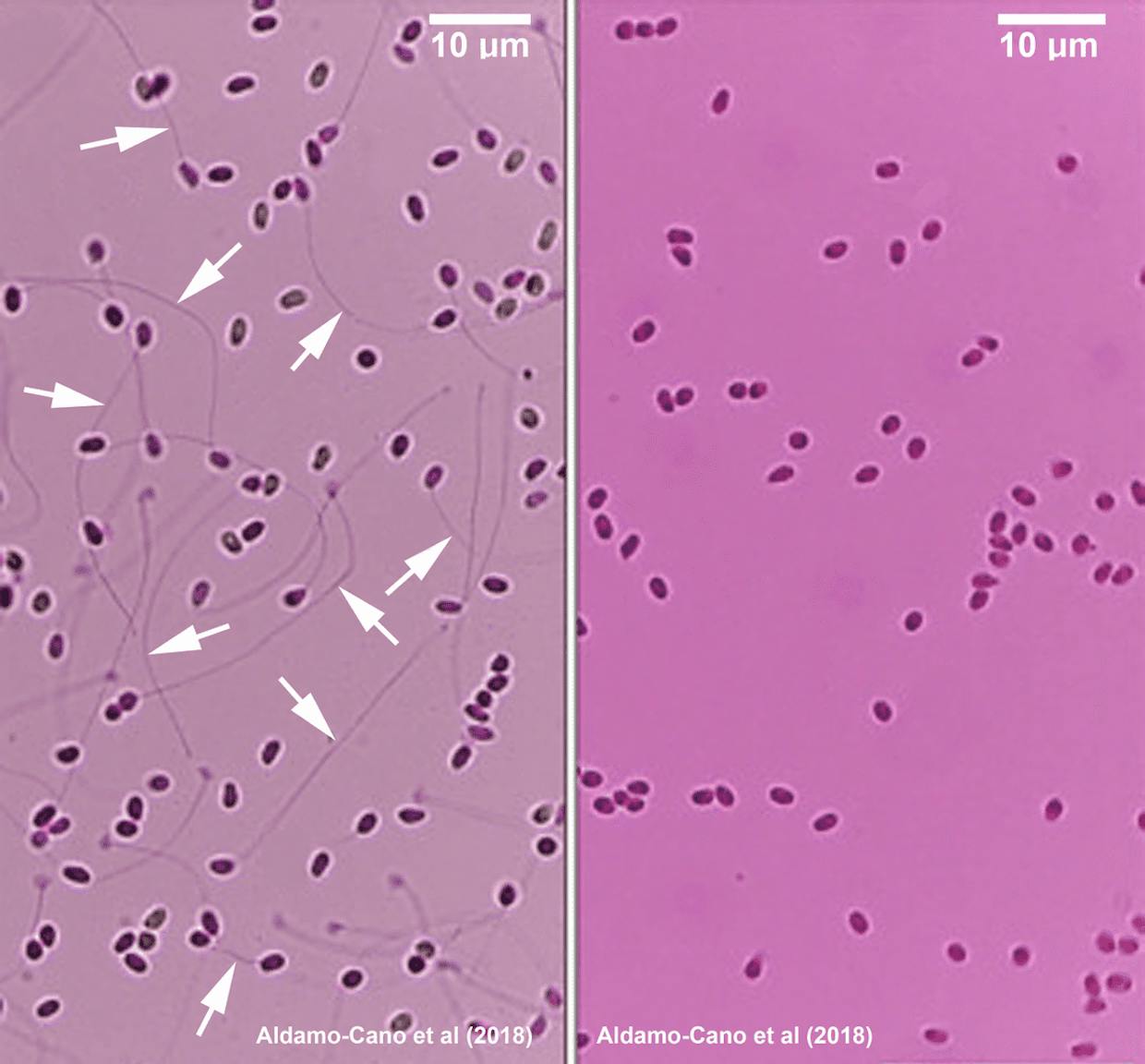 Inactivated extruded EHP spores (LEFT), infective non-extruded EHP spores (RIGHT), extruded polar tubes (WHITE ARROWS)