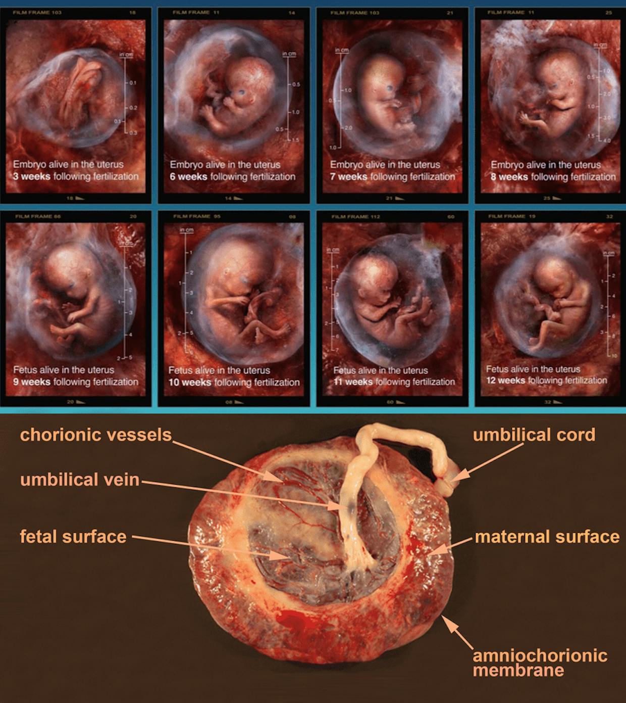 Fetal development illustration courtesy of 