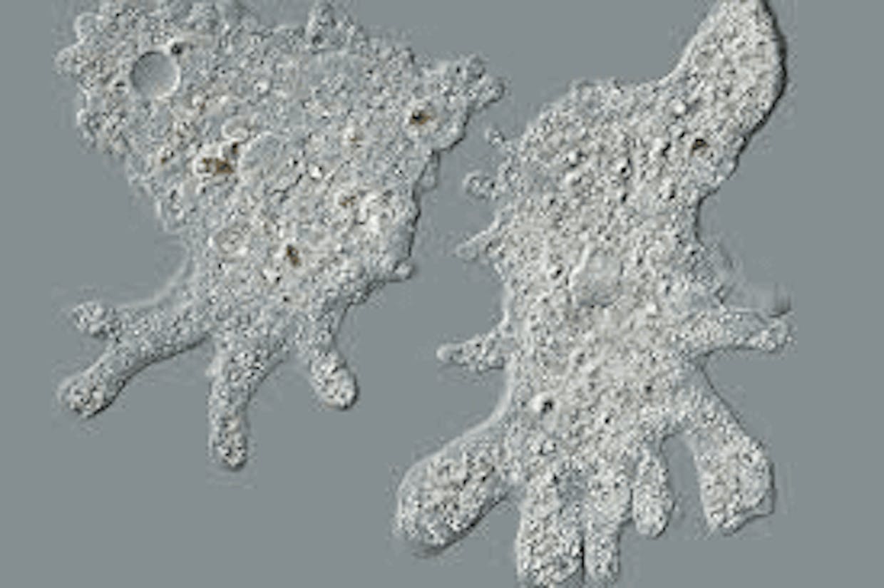 Amoeba (under microscope)